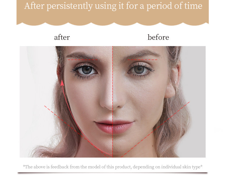 KD907S Roller Beauty Device