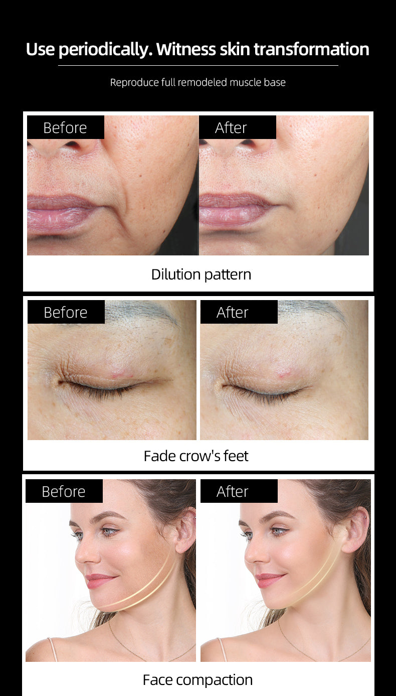 KD8088 Ultrasonic radio frequency meter